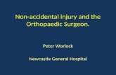 Non-accidental injury and the Orthopaedic Surgeon. Peter Worlock Newcastle General Hospital.