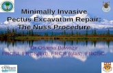 Minimally Invasive Pectus Excavatum Repair: The Nuss Procedure Dr Osama Bawazir FRCSI, FRCS(Ed), FRCS (glas), FRCSC.