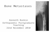 Bone Metastases Kenneth Rankin Orthopaedic Postgraduate Teaching 22nd November 2010.