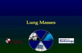 Lung Masses. Common causes of a mass on a CXR Benign nodules Primary lung cancer Metastatic disease Lung abscess There are many other causes, but these.