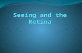 -Review of Retinal Physiology -Seeing Edges with the Retina -Retinal Implants.