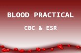 BLOOD PRACTICAL CBC & ESR. Aims of the Practical 1.Counting Red blood cells. 2.Counting White blood cells. 3.Determination of hemoglobin concentration.