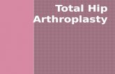 Total Hip Arthroplasty.  Hip joint anatomy  What is THA  Indications for THA  Characteristics/Clinical presentation of indications  Diagnostic Fx.