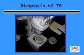 Diagnosis of TB. Learning Objectives List the 4 principle components of a TB evaluation Describe the criteria which differentiate PTB+ from PTB- Describe.