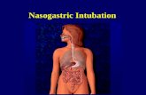 Nasogastric Intubation. GI Tract Oral cavity Pharynx Esophagus Stomach Small Intestine Large Intestine Accessory Structures.