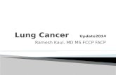 Ramesh Kaul, MD MS FCCP FACP.  Lung cancer is a Global disease In 2012, there were 1.82 million new cases globally, and 1.56 million deaths due to lung.