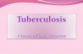 Tuberculosis Causative Organism Mycobacterium Tuberculosis Gram-positive, acid-fast bacillus ( AFB)