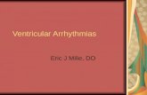 Ventricular Arrhythmias Eric J Milie, DO. Goals and Objectives.
