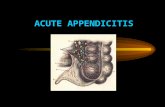 ACUTE APPENDICITIS. Acute appendicitis is an inflammation of a vermiform appendix caused by purulent microflora. Approximately 7 percent of the population.