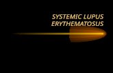 SYSTEMIC LUPUS ERYTHEMATOSUS. DEFINITION AND PREVALENCE Systemic lupus erythematosus (SLE) is a disease of unknown etiology in which tissues and cells.