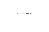 Arrhythmias. Rhythms and Arrhythmia SA Node – Normal sinus rhythm – Sinus Bradycardia – Sinus Tachycardia – Sick Sinus Syndrome Atria – Ectopic beats.