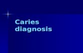 Caries diagnosis. Etiology of dental caries four factors are necessary to produce dental caries to produce dental caries  Dental plaque  A suitable.