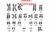 s Notes: Karyotypes Human Chromosomes- what you know… Humans have 46 chromosomes (diploid-2N) 2 of them are sex chromosomes (X and Y)  they determine.