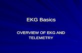EKG Basics OVERVIEW OF EKG AND TELEMETRY. Outline 1. Review of the conduction system 2. EKG waveforms and intervals 3. EKG leads 4. Determining heart.
