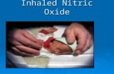Inhaled Nitric Oxide. A study on the effects of inhaled Nitric Oxide (iNO) in neonatal Pulmonary Hypertension by:  Cecilia Cherian  Marc Chiappetta.
