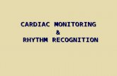 CARDIAC MONITORING & RHYTHM RECOGNITION. How to monitor the ECG (1): Monitoring leads 3-lead system approximates to I, II, III3-lead system approximates.
