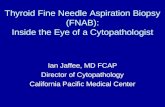 Thyroid Fine Needle Aspiration Biopsy (FNAB): Inside the Eye of a Cytopathologist Ian Jaffee, MD FCAP Director of Cytopathology California Pacific Medical.
