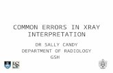 COMMON ERRORS IN XRAY INTERPRETATION DR SALLY CANDY DEPARTMENT OF RADIOLOGY GSH.