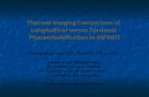 Thermal Imaging Comparison of Longitudinal versus Torsional Phacoemulsification in INFINITI Young Keun Han, M.D., Kevin M. Miller, M.D. Department of Ophthalmology,