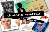 By Abdul Hameed Jan Alcoholic Hepatitis. Outline Outline: 1.Intro 2.Definition 3.Pathogenesis 4.Symptoms 5.Clinical signs 6.Treatment 7.Complications.