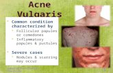 Common condition characterized by  Follicular papules or comedones  Inflammatory papules & pustules  Severe cases  Nodules & scarring may occur copyrights:oibconsultantsin.