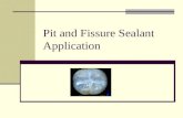 Pit and Fissure Sealant Application. Rules / Regulations Must be EFDA Expanded Function Dental Assistant. Certified by: DANB Dental Assisting National.