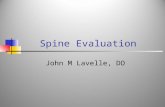 Spine Evaluation John M Lavelle, DO. History Onset of Pain: acute or chronic? Location of Pain: midline, lateralized? Radiation of Pain: down one leg.