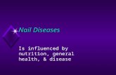 Nail Diseases Is influenced by nutrition, general health, & disease.