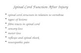 Spinal Cord Function After Injury spinal cord structure in relation to vertebrae types of lesions fibre tracts in spinal cord sensory loss motor loss reflexes.