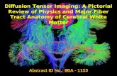Diffusion Tensor Imaging: A Pictorial Review of Physics and Major Fiber Tract Anatomy of Cerebral White Matter Abstract ID No.: IRIA - 1153.