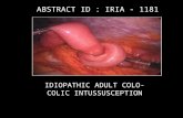 IDIOPATHIC ADULT COLO- COLIC INTUSSUSCEPTION ABSTRACT ID : IRIA - 1181.