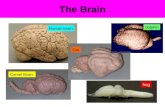 The Brain Human brain Camel Brain Cat dolphin frog.