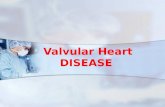 Valvular Heart DISEASE. What is Valvular Heart Disease?
