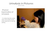 Physical Examination of Urinalysis I’m observing the amber color and cloudy of the urine specimen in the lab setting Urinalysis in Pictures by Yen Truong.