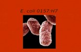 E. coli 0157:H7. Presented by Kendra McQueen Jennifer Rasmussen Edward Guevara.