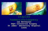 Stapled haemorrhoidopexy Ian Botterill Dept Colorectal Surgery St James’ University Hospital Leeds.