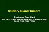 1 Salivary Gland Tumors Professor Ravi Kant MS, FRCS (Edin), FRCS (Glasg), FRCS (Ireland), DNB, FACS, FICS, FAIS, FAMS.