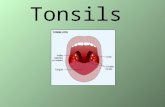 Tonsils. Tonsils are large lymphoid tissue situated in the lateral wall of the oropharynx. They form lateral part of the Waldeyer's ring. Tonsil occupies.