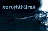 Xerophthalmia Literaly means “dry eye” Literaly means “dry eye” Ocular abnormalities from vitamin A deficiency (nutritional deficiency) Ocular abnormalities.