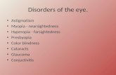 Disorders of the eye. Astigmatism Myopia - nearsightedness Hyperopia - farsightedness Presbyopia Color blindness Cataracts Glaucoma Conjuctivitis.