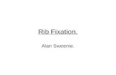Rib Fixation. Alan Sweenie.. History. Evidence. Barriers to obtaining more evidence. How it is done. Our experience. Referral process.