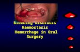 Bleeding Disorders Haemostasis Hemorrhage in Oral Surgery.
