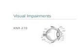 Visual Impairments KNR 270. Visual Impairments  What is visual acuity? Amount of detail that can be seen Clearness  What is visual field? Entire area.