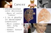 Cancer Uncontrolled cell division –Mass of cells: ‘tumour’ 1 in 4 deaths in developed countries –Most common in men: lung cancer –Women: breast cancer.