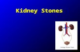 Kidney Stones. EpidemiologyEpidemiology Bladder and kidney stones detected in Egyptian mummies dating back to 4800 BC Bladder and kidney stones detected.
