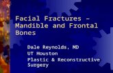 Facial Fractures – Mandible and Frontal Bones Dale Reynolds, MD UT Houston Plastic & Reconstructive Surgery.