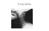 X ray spine. SPINE TRAUMA CERVICAL SPINE INJURY THORACO-LUMBAR SPINE INJURY.