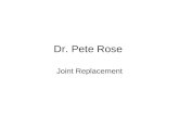 Dr. Pete Rose Joint Replacement. Total = Ball + Socket.