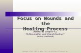 Focus on Wounds and the Healing Process (Relates to Chapter 13, “Inflammation and Wound Healing,” in the textbook) Copyright © 2011, 2007 by Mosby, Inc.,