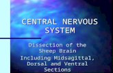 CENTRAL NERVOUS SYSTEM Dissection of the Sheep Brain Including Midsagittal, Dorsal and Ventral Sections.
